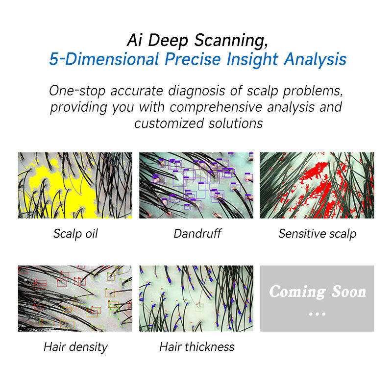AI Deep Scanning 5D: scalp oil, dandruff, sensitive scalp, hair density e hair thickness